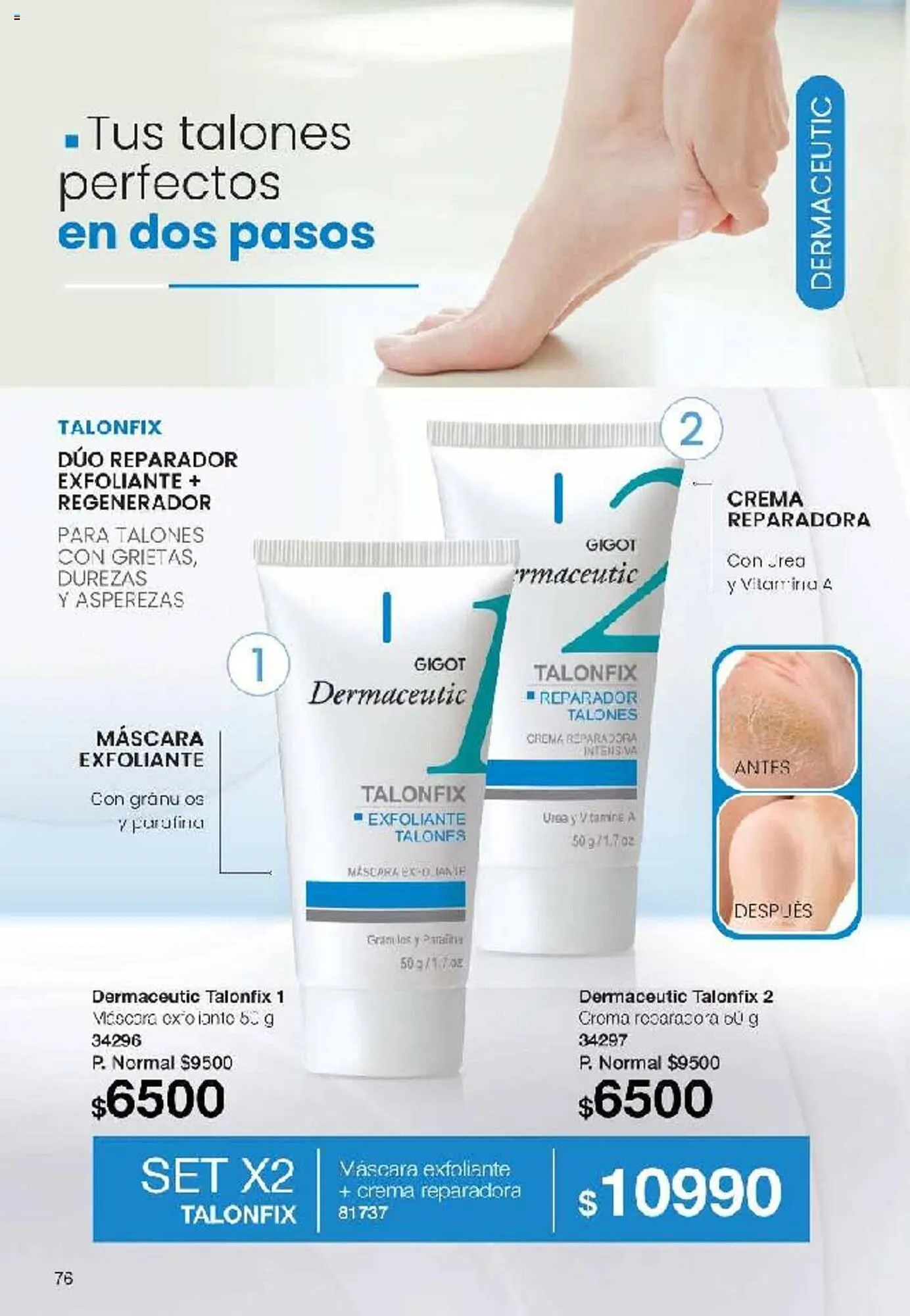 Ofertas de Catálogo Gigot 29 de julio al 11 de agosto 2024 - Página 76 del catálogo