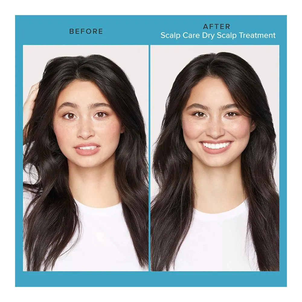 Scalp Care Dry Scalp Treatment