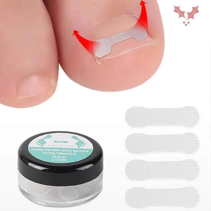 10pcs Ingrown Toe Nail Treatment Ingrown Toenail Correction Tool Elastic Patch Sticker Straightening Clip Brace Pedicure Tools