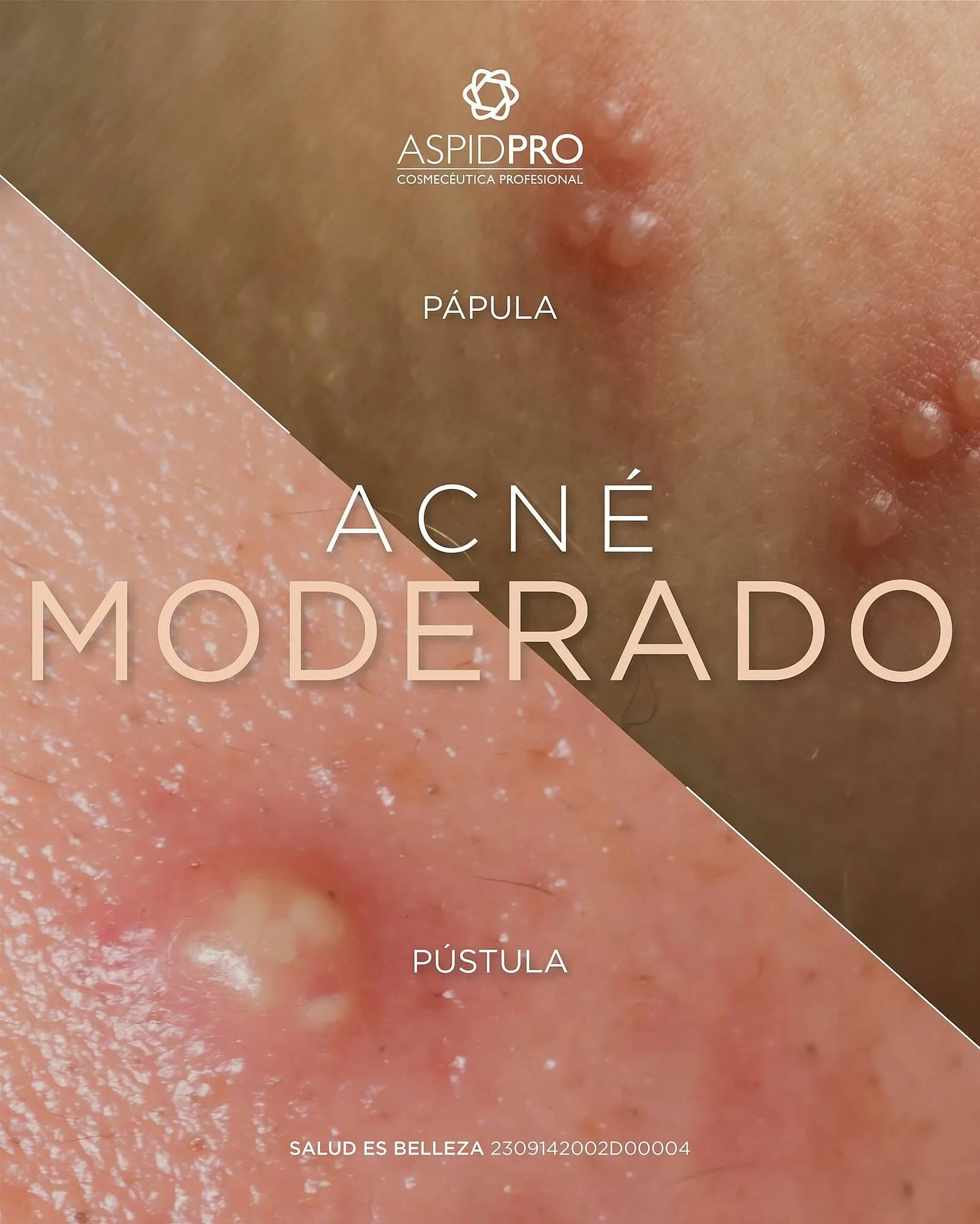 Catálogo de Catálogo AspidPro 11 de julio al 11 de julio 2025 - Pagina 3