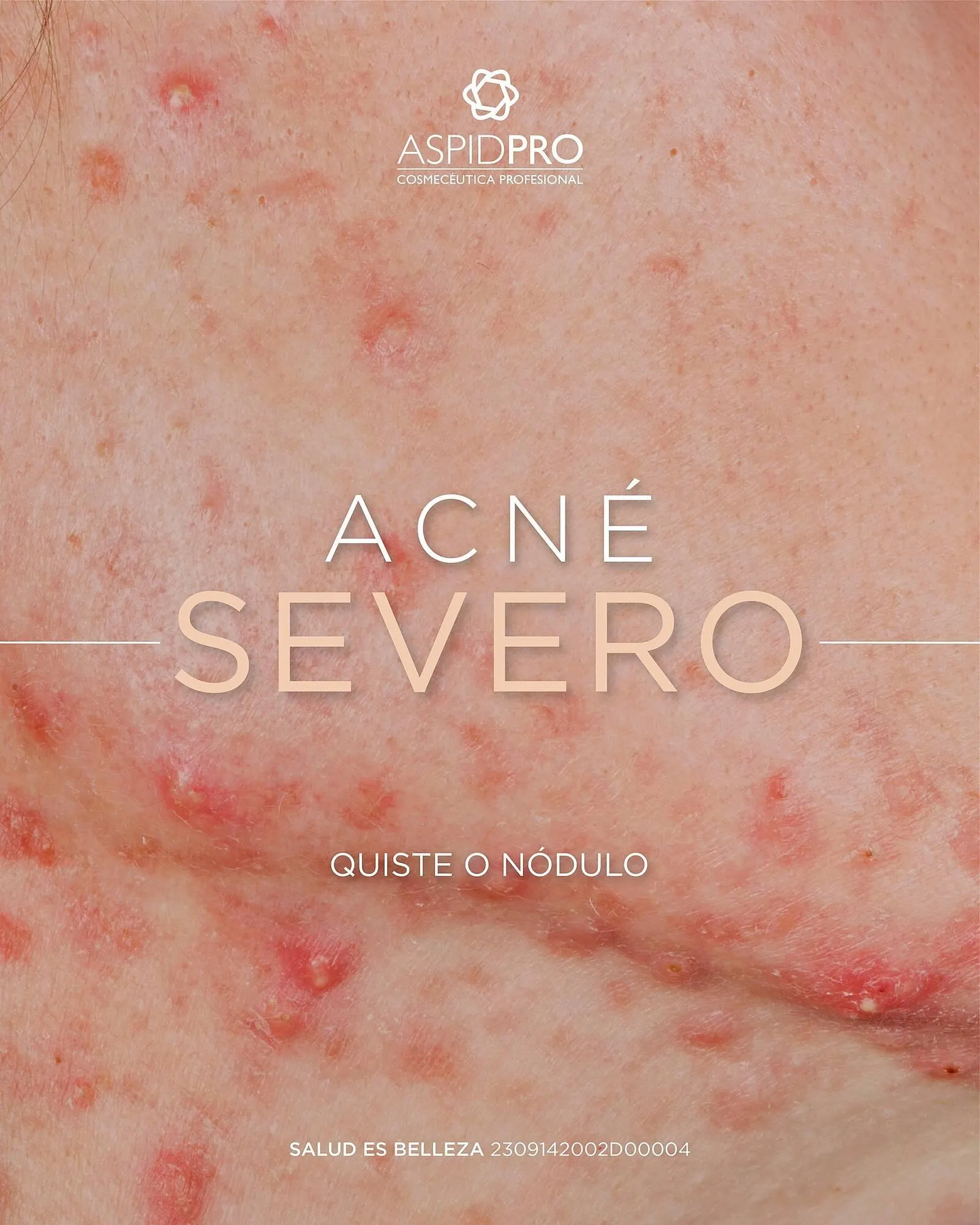 Catálogo de Catálogo AspidPro 11 de julio al 11 de julio 2025 - Pagina 4