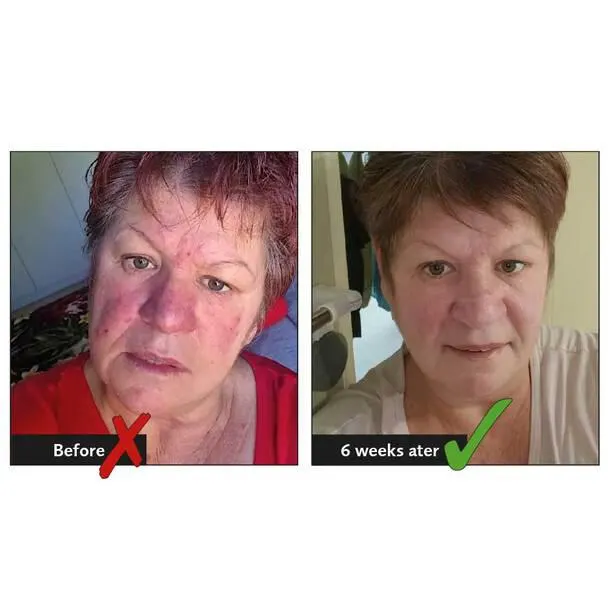 Zero BS Face Butter (50ml)