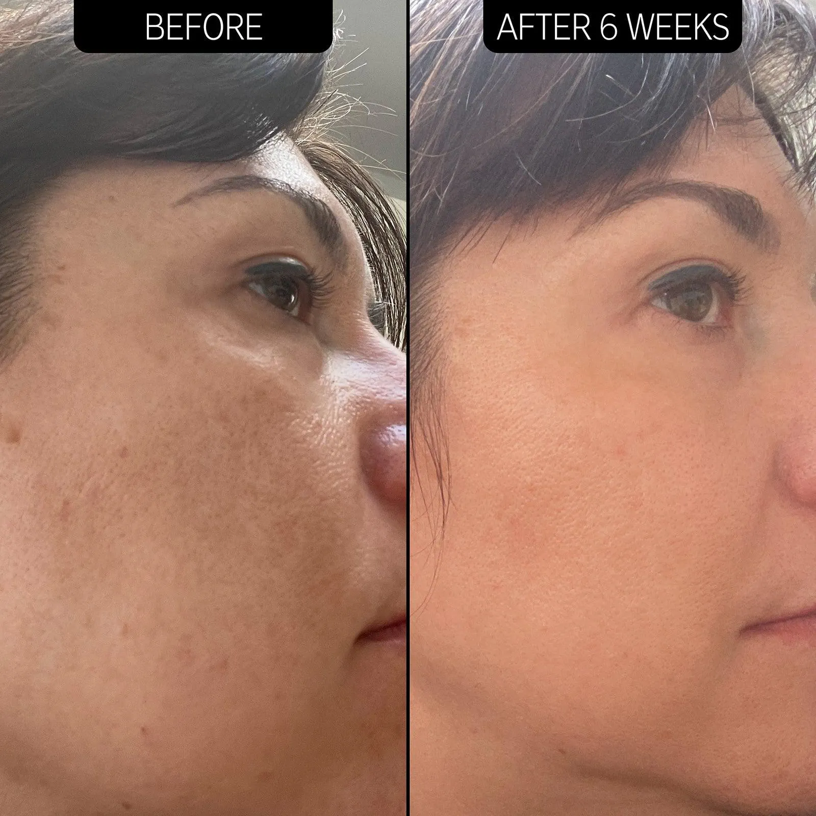 Scar, Mark and Wrinkle Solution