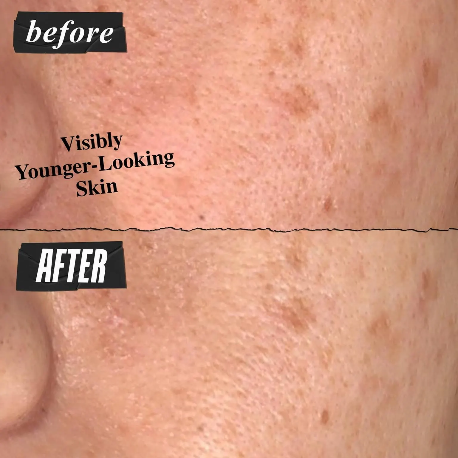 Super Multi-Corrective Anti-Aging Cream for Face and Neck